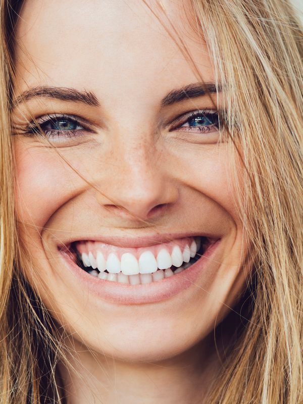 Smile Makeover Benefits