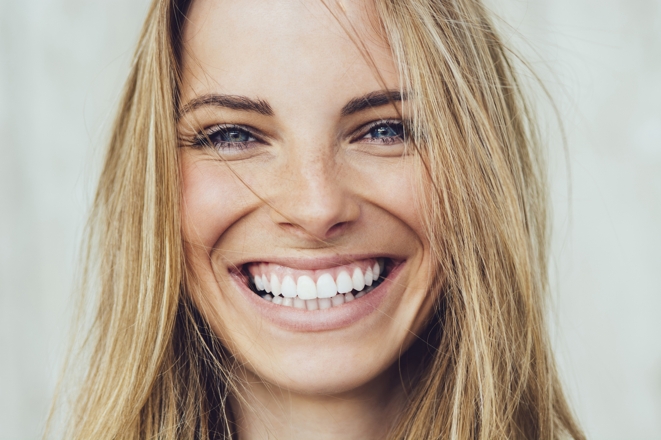 Smile Makeover Benefits