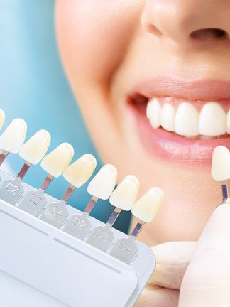 Smile Makeover Process - Matching Veneers Colors with Natural Teeth