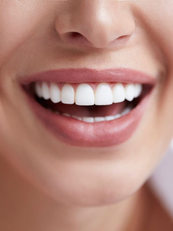 Teeth Whitening Benefits