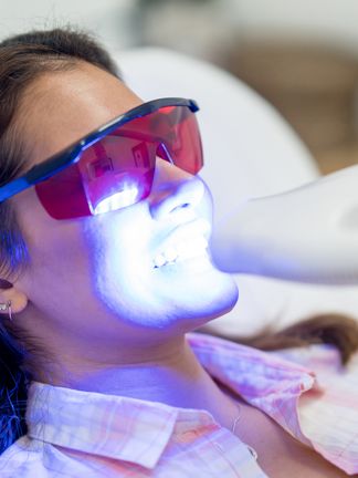 Teeth Whitening Treatment