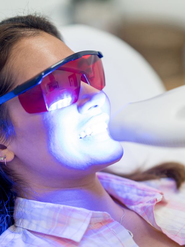 Teeth Whitening Treatment